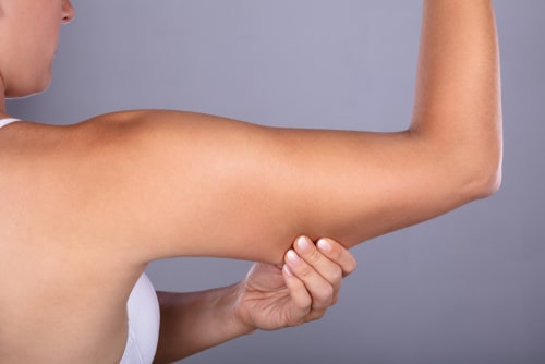 Surgical Arm Lift vs. Laser Arm Lift - Which is Best?