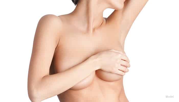 Breast augmentation model