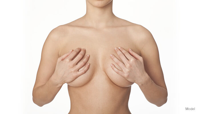 Fat transfer to breast model