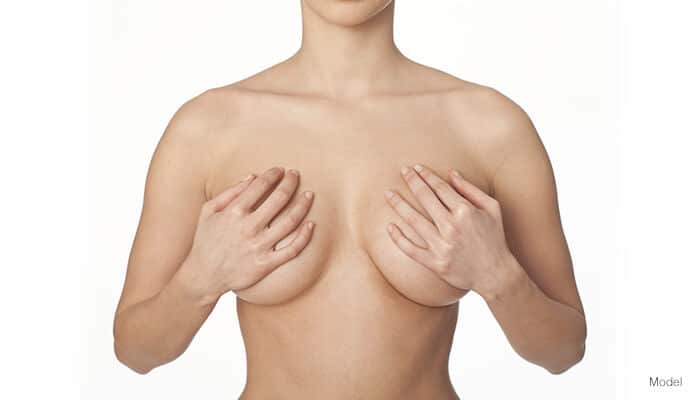 Fat transfer to breast model