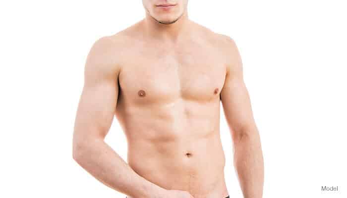 Gynecomastia male model